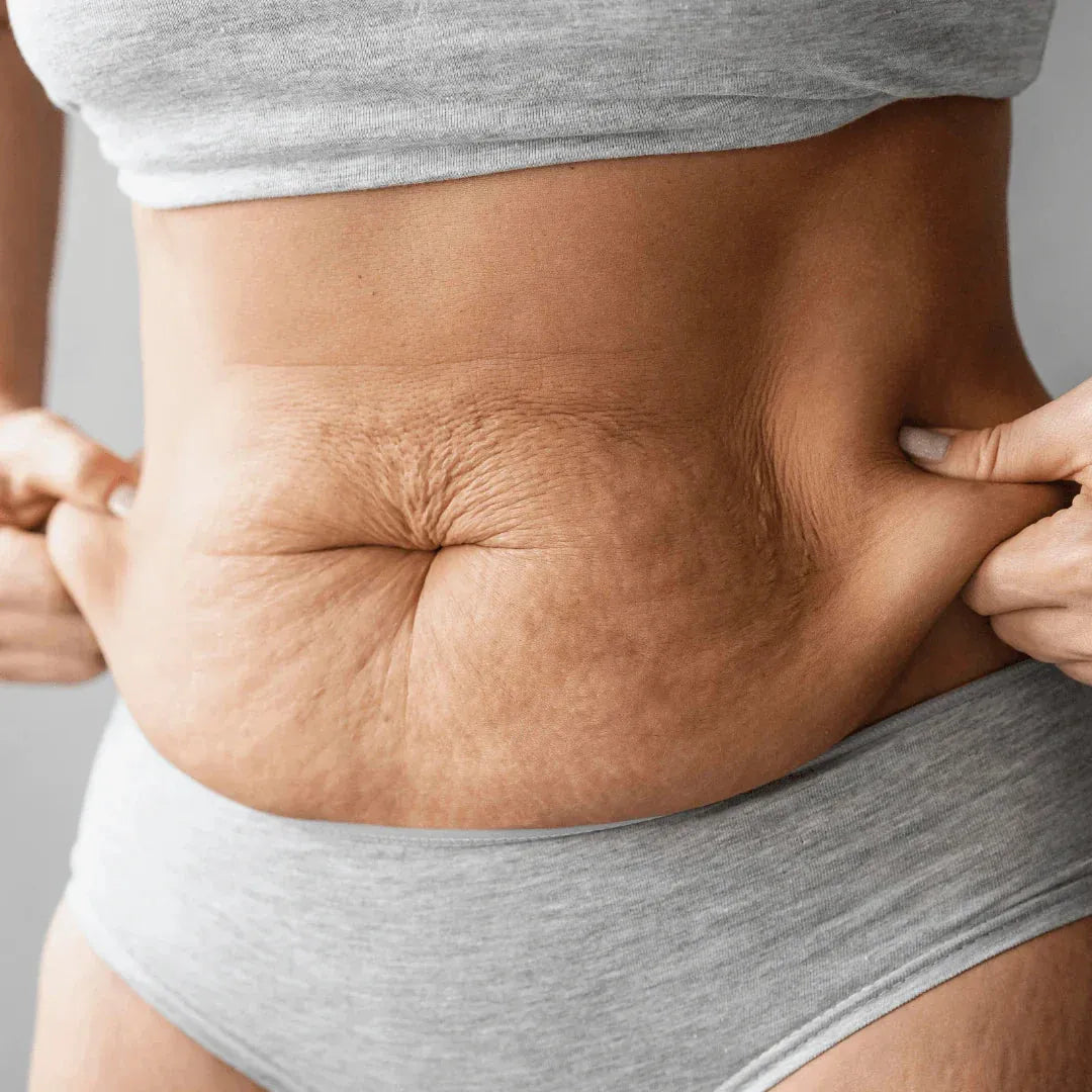 6 Proven Ways to Tighten Loose Skin Naturally and Effectively
